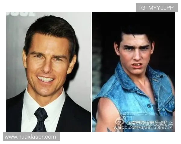 足球明星整牙背后的故事与改变人生的微笑之旅